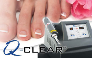 laser toe nail treatment