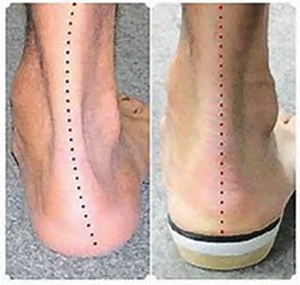 ankle