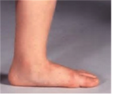 foot